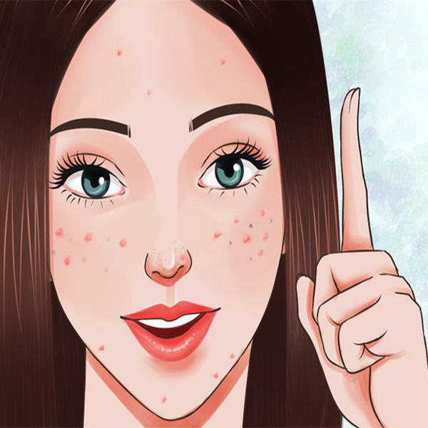 cách điều trị mụn ẩn